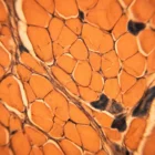 Sezione di fibre muscolari scheletriche in tonalità arancioni, immagine istologica