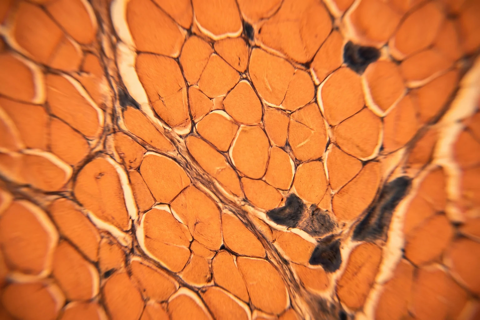 Sezione di fibre muscolari scheletriche in tonalità arancioni, immagine istologica